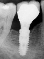 West Cobb Dentistry image 1